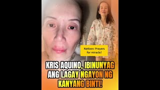 Kris Aquino, ibinunyag ang lagay ngayon ng kanyang binti