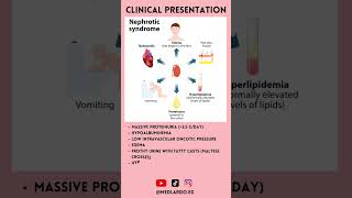 Nephrotic syndrome in a minute #medicine #doctor #medschool #medicalstudent  #nephroticsyndrome