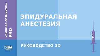 Эпидуральная анестезия. 3D руководство