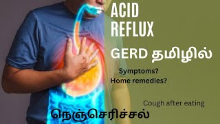 GERD in tamil | gerd tamil | symptoms | remedies