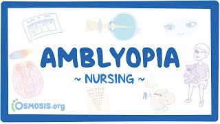 Amblyopia: Clinical Nursing Care