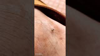 Mosquito 🦟 funny video #reelsindia #subscribe #viral #sad #support #viralreels #funnyvideo