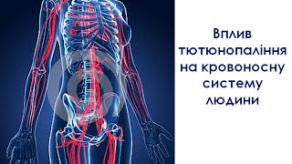 Вплив тютюнопаління на кровоносну систему