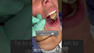 ¡Usa brackets y mis dientes volvieron a moverse! Visita nuestra web y entérate por qué 😨