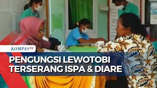 Pengungsi Lewotobi Terserang ISPA & Diare