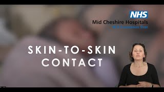 Skin to skin | British Sign Language