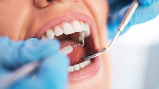 How Do we care for permanent Teeth