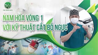 Nam hóa vòng 1 với kỹ thuật cắt bỏ ngực