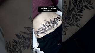 Cubrimiento de enorme cicatriz #tattoo #tatuaje #andrewperdomo