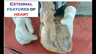 Heart -1- EXTERNAL FEATURES OF HEART (Anatomy) - Simplified demonstration by Dr. Ashok - Made easy