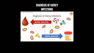 Diagnosis of kidney infections #kidneydisease #infection #renalcare #kidneyhealth