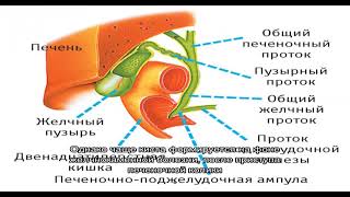 Киста желчного пузыря