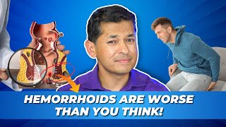 The Brutal Truth About Hemorrhoids (And Why You Can’t Ignore Them)