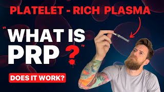 What is PRP & does it work? - NATURAL Healing with Platelet Therapy