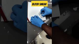 Prepare a perfect blood Smear 🩸#medical #viralvideo  #youtube #pathology #ytshort #ytviral#yt #lab