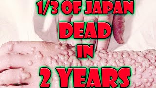 The Japanese Plague You've Never Heard Of (That Changed History)