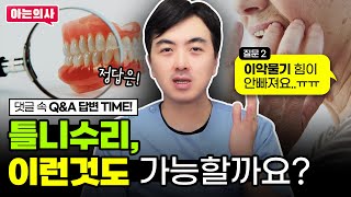 틀니수리 이런것도 가능할까요? 댓글에 답해드립니다!