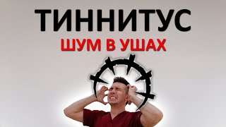 Как избавиться от шума в ушах (тиннитуса). Самая ЛУЧШАЯ инструкция