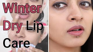 Winter Lip Care Tips | How to Prevent & Treat Dry Lips