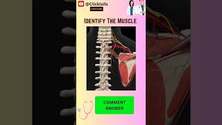 Identify the Muscle of upper limb quiz #upperlimbanatomy #anatomy #humananatomy