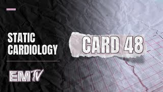 STATIC CARDIOLOGY: CARD 48