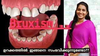 Bruxism causes and treatment in Malayalam | Dr. Anagha Cheleri