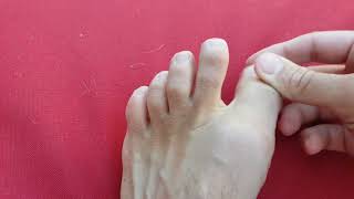 Big toe joint pain and problems explained