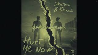 Skytech & Dannic - Hurt Me Now (Tropical x DJMatthew Remix)