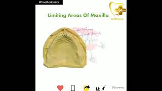 INBDE/NEETMDS/INICET-Limiting areas of Maxilla