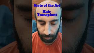 Hairtransplant @DesignerDoctor #shorts #trending #dermatologist