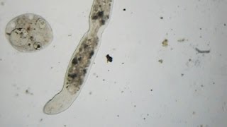 Stenostomum leucops and Ciliates