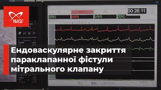 Ендоваскулярне закриття параклапанної фістули мітрального клапану 🔷 Інститут серця