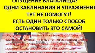 опущение стенок влагалища