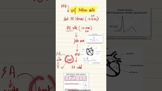 Wolf Parkinson White Syndrome