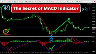 MACD Trading Strategy in Hindi || Best MACD Settings for Intraday