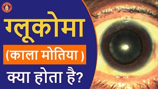 MID- काला मोतियाबिंद या Glaucoma क्या होता है ? | How Glaucoma Affects Your Eye Structure?