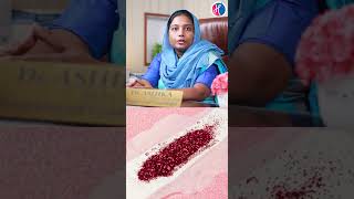 Treatment for Premature Ovarian Failure in Tamil |Reason for not getting Pregnant | Dr Ashika