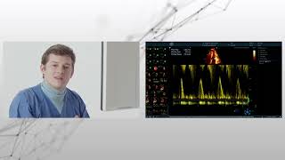 〖Measurements〗 Apical 4-ChV & 5-ChV part II 〖Echocardiography〗 💫 💟