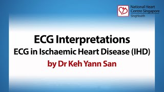 ECG Interpretations: ECG in Ischaemic Heart Disease (IHD) - Basic ECG March 2022