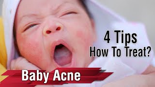 Baby Acne or Rash