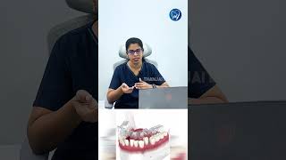 எப்படி Invisalign உங்க பற்களை நேராக்குது? #thanjaidentalcentre