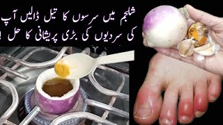 CHILBLAINS Treatment | Home Remedy For Swollen Fingers During Winter |