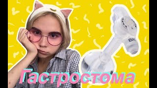 Всё о гастростоме, или о том как я живу живу с дыркой в животе!