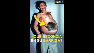 Ocultó un secreto en su barriga por 36 años 🤫 #curiosidades