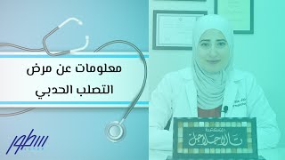 معلومات عن مرض التصلب الحدبي