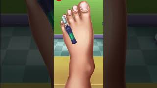 Foot Nails treatment