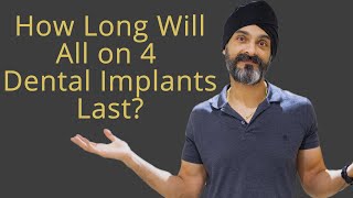 How long do All on 4 or a Full Set Of Implants Last?