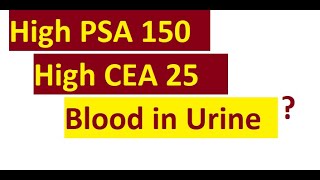 Explain PSA 150 CEA 25 Bloody urine meaning