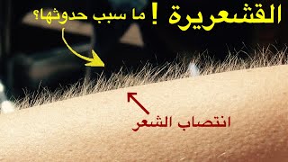 مراجعة القشعريرة  goosebumps وسبب حدوثها