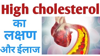 high cholesterol symptoms in hindi | हाई कोलेस्ट्रॉल के लक्षण | हाई कोलेस्ट्रॉल की समस्या